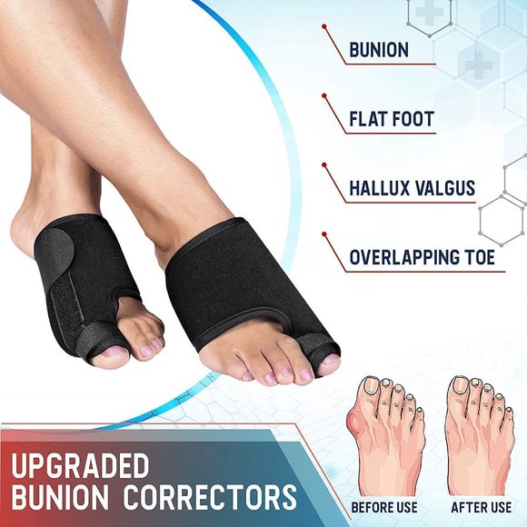 Bunion Corrector and Bunion Relief - Picture 2 of 4